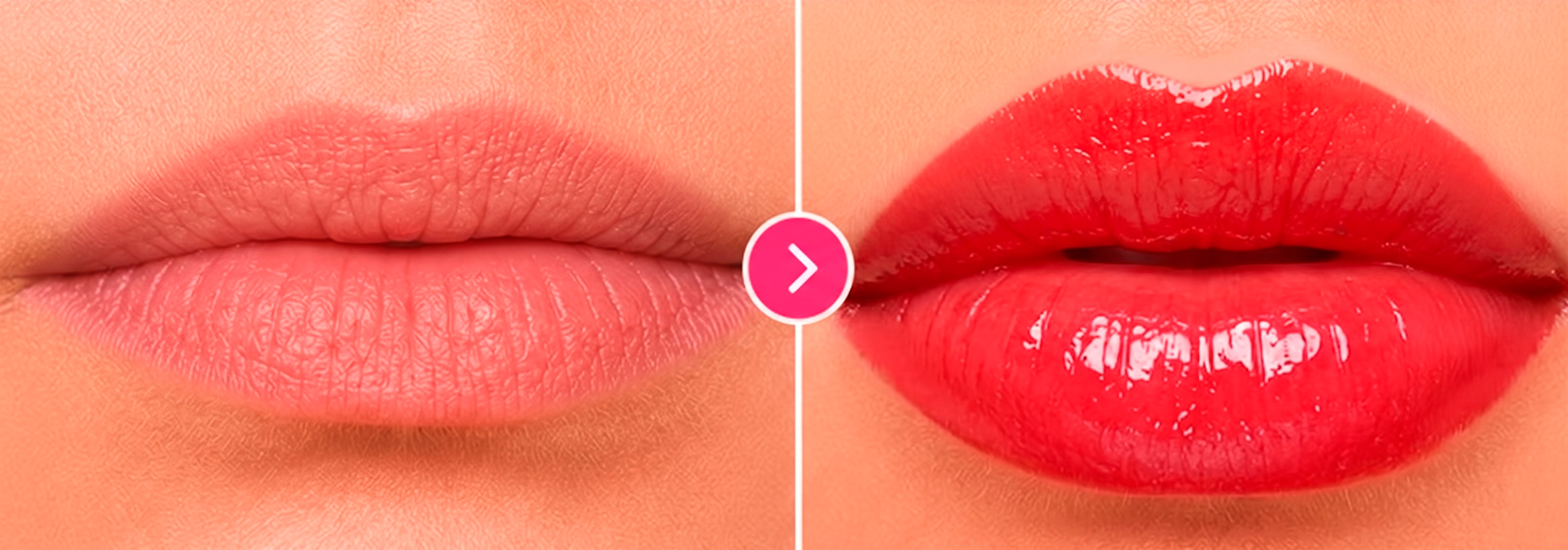 Antes e depois Smart Lips Care Maçã do Amor