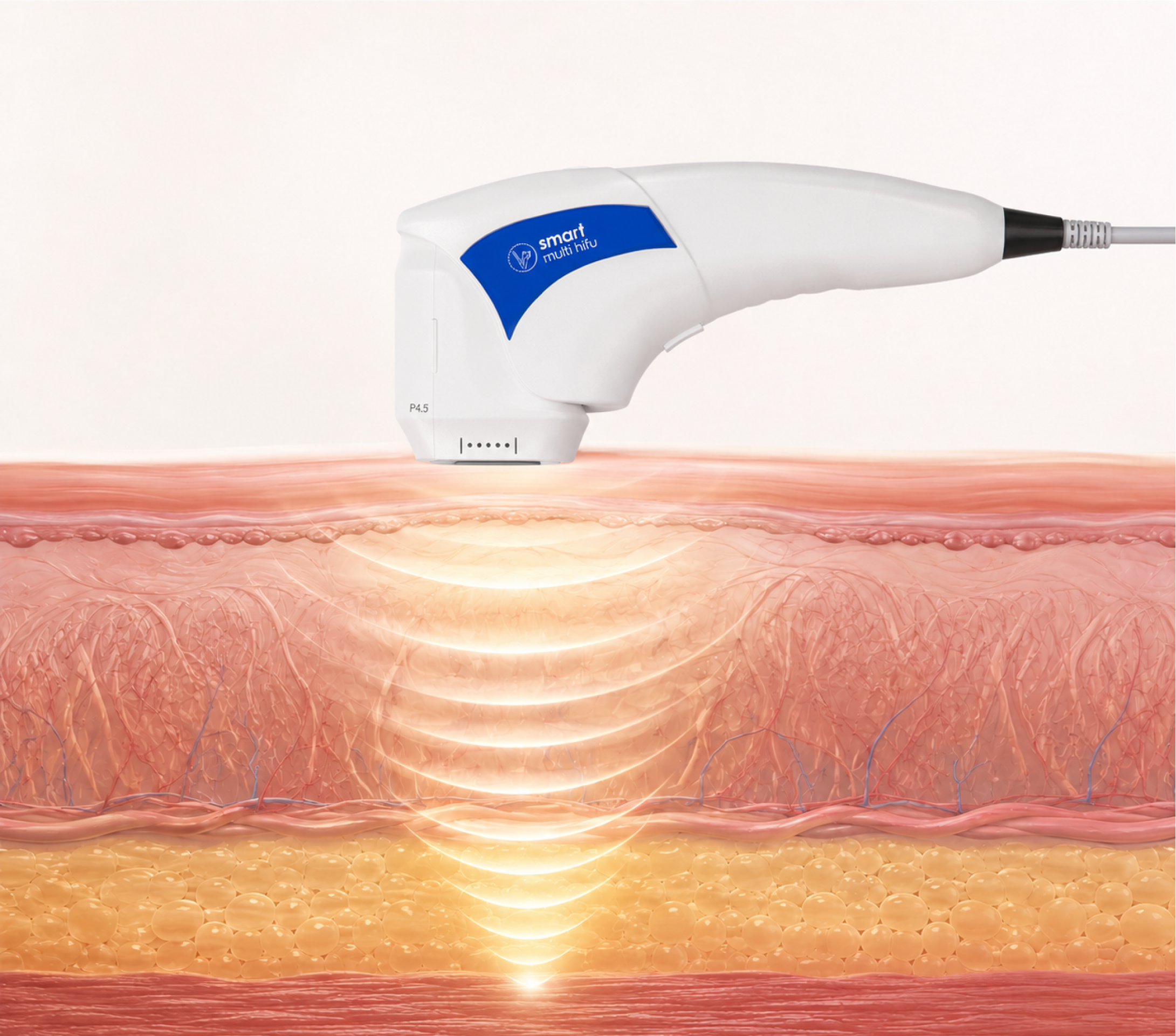 Imagem Smart Multi HIFU - camadas da pele